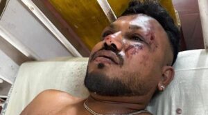 ایئر انڈیا طیارے کے حادثے کا 'واحد زندہ بچ جانے والا' خوفناک تجربہ ہے