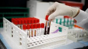 فرانسیسی سائنس دانوں کو گواڈیلوپ عورت میں خون کی نئی قسم ملتی ہے