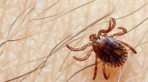 کراچی کے جناح اسپتال میں دو ڈاکٹروں کانگو وائرس کی شبہ کی علامات کی نمائش کرتے ہیں