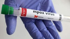 لاہور میں پہلے MPOX کیس کی تصدیق 48 سالہ جگر کے ٹرانسپلانٹ مریض کے ٹیسٹ مثبت کے طور پر ہوئی ہے